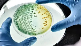 科学家追踪牲畜系统如何充当耐药细菌的储存库
