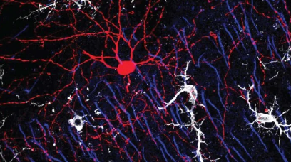 沟通障碍你的大脑如何防止神经元不受控制地放电